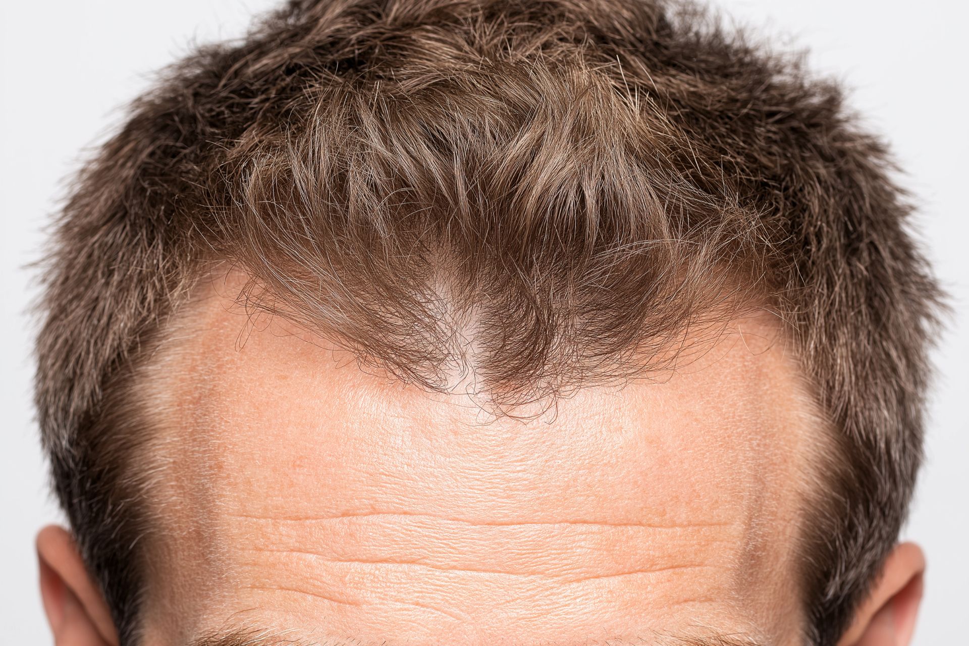 Haartherapie Hannover Haarausfall stoppen - volles Haar